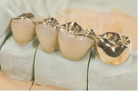As obturações dentárias são feitas de amálgama